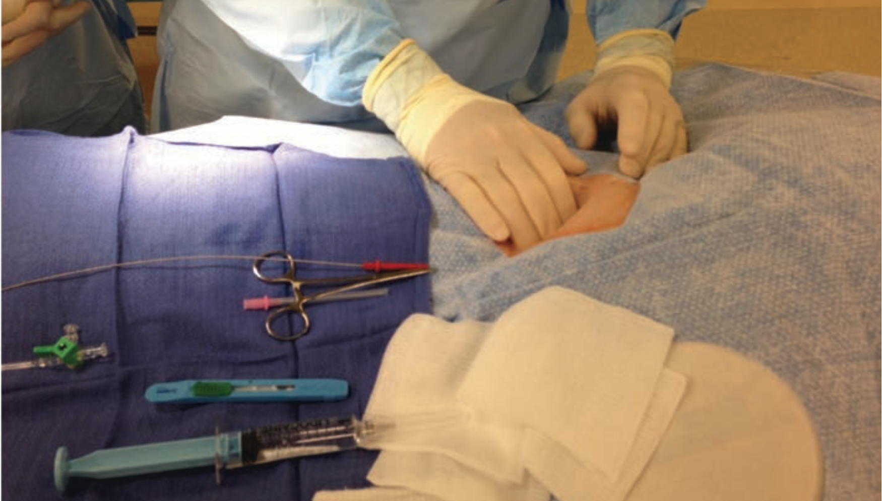 Back to Basics Femoral Artery Access and Hemostasis